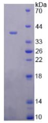 SDS-PAGE (FOLH1-7844H).jpg